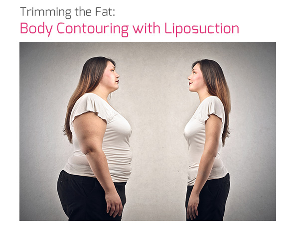 Trimming the Fat: Body Contouring with Liposuction