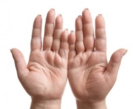 Contact Dermatitis