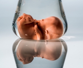 IVF prague