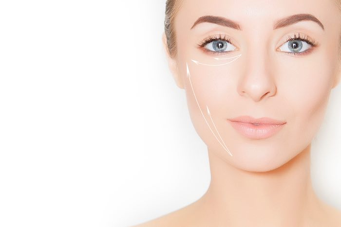 eyelid surgery
