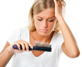 alopecia