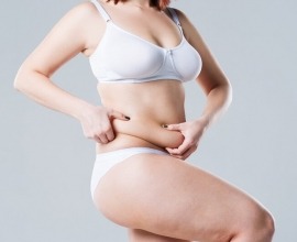 liposuction
