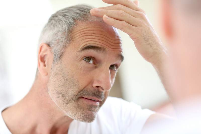 FUT, Hair Loss